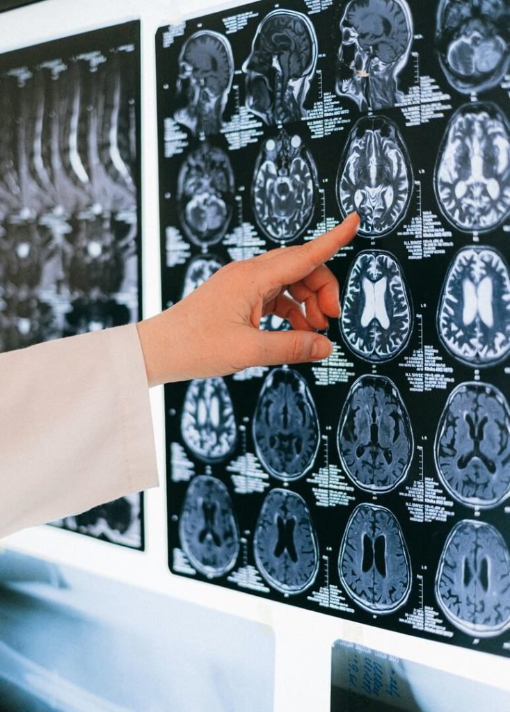 Difference Between Tetraplegia And Quadriplegia
